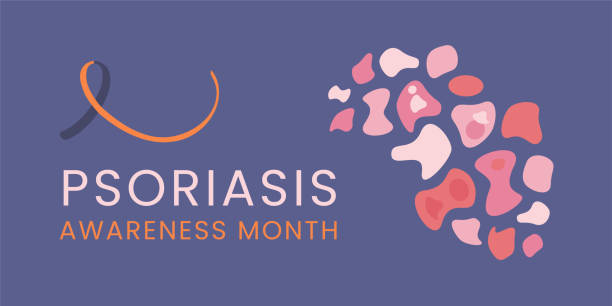 illustrations, cliparts, dessins animés et icônes de affiche ou bannière du mois de sensibilisation au psoriasis. - psoriasis