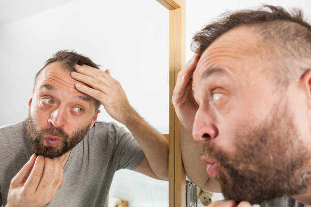 istock Worried man looking at his decreasing hairline 1265924280
