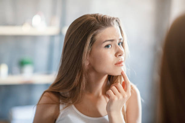 Upset young girl touching pimple on her chin in front of mirror at home Upset millennial girl touching pimple on her chin in front of mirror at home chin stock pictures, royalty-free photos & images