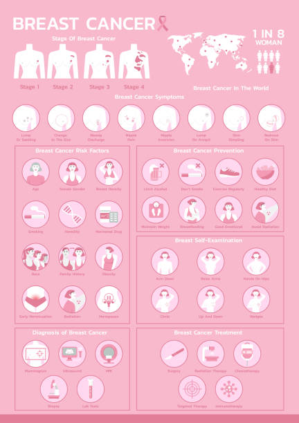 Poster infographic of breast cancer awareness infographic of breast cancer awareness, stage, symptoms, risk factors, prevention, self-examination, diagnosis and treatment, poster healthcare and medical, layout template vector illustration medical infographics stock illustrations