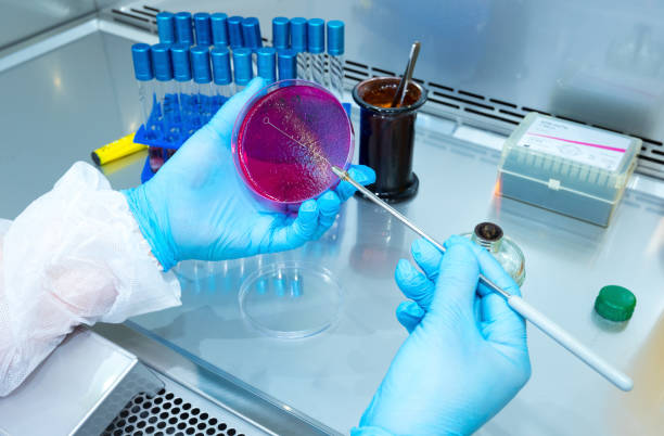 hand holds petri dish with bacteria culture - petri dish bacterium colony laboratory imagens e fotografias de stock