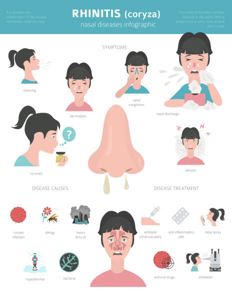 30 Nasal Irrigation Stock Illustrations Royalty Free Vector Graphics 30-nasal-irrigation-stock-illustrations-royalty-free-vector-graphics