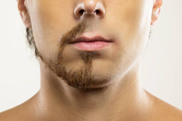 man face with a partially shaved beard. - stubble imagens e fotografias de stock