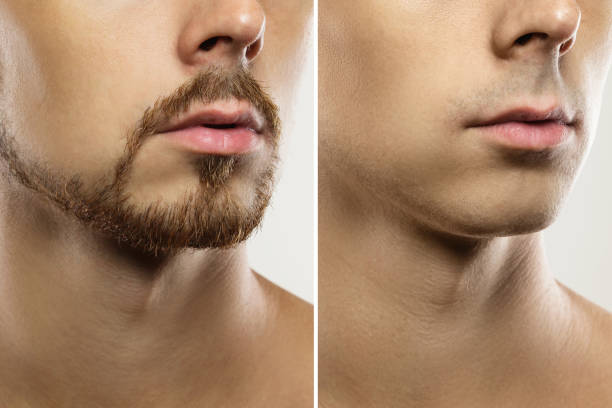 シェービング結果を持つ男性の顔 - 無精ヒゲ ストックフォトと画像