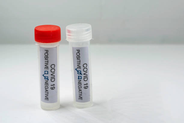 badanie na obecność coronavirus. probówka zawierająca próbkę wacika, która uzyskała wynik pozytywny dla covid-19. - carpet sample zdjęcia i obrazy z banku zdjęć