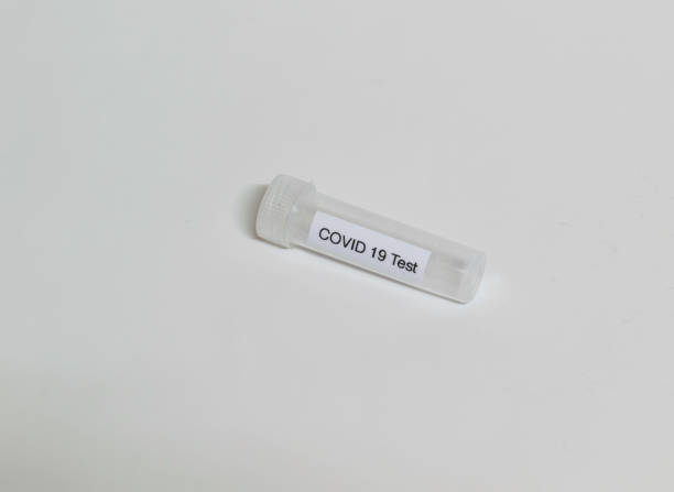 probówka z próbką do testu wirusa sars-cov-2 lub covid-19 - carpet sample zdjęcia i obrazy z banku zdjęć