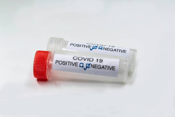 teste para presença de coronavírus. tubo contendo uma amostra de cotonete que deu positivo para covid-19. - carpet sample - fotografias e filmes do acervo
