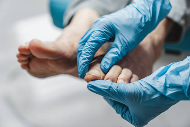 podólogo tratando los pies durante el procedimiento - pedicure human foot spa treatment health spa fotografías e imágenes de stock