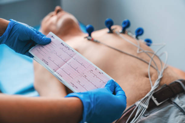 elektrokardiogramm, ekg in der hand. kardiogramm ausdruck auf männlichem patientenhintergrund - pulse trace arrhythmia electrode listening to heartbeat stock-fotos und bilder