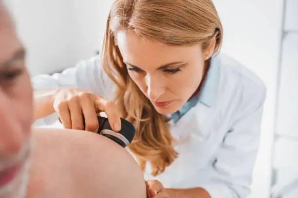 Photo of Doctor dermatologist examines skin of patient. Dermatoscopy, prevention of melanoma, skin cancer.