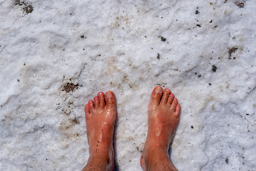 Bare, wet feet of a man standing on a dried salt lake floor. The man's skin is reddened by sunburn. Drought, environment, global warming and climate change concept. Top view with copy space.
