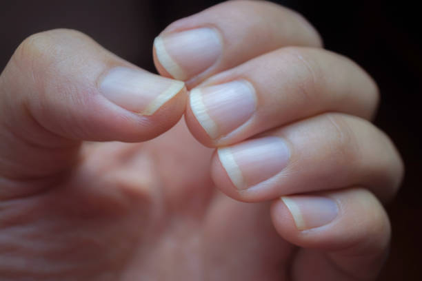 istock Male nails are clean, but long nails can be a source of germs. Should be cleaned, men's hands have long nails on a black background, long man nails on a black background have light shining on the back 1267073415
