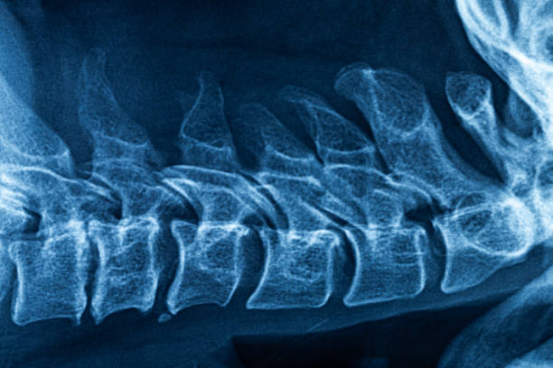 kręgi szyjne mostek rtg film - x ray equipment x ray machine radiation zdjęcia i obrazy z banku zdjęć