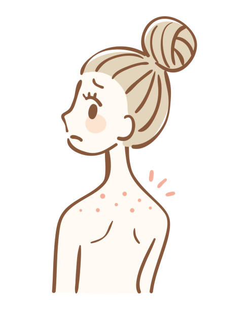 Woman with acne on her back Woman with acne on her back woman beehive stock illustrations