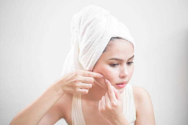 istock A woman is popping a pimple 1267470620