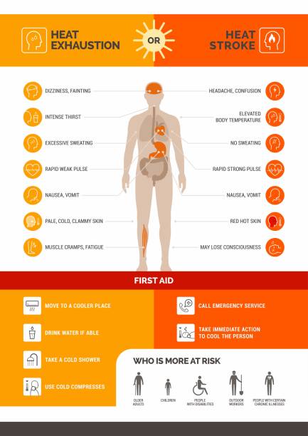 Heat exhaustion and heast stroke infographic Heat exhaustion and heat stroke healthcare infographic: symptoms and first aid exhaustion stock illustrations