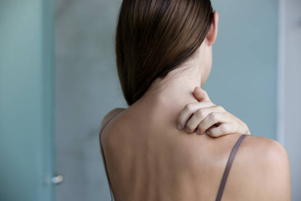 крупным планом вид женщины царапин шею. - dermatitis dry human hand human skin стоковые фото и изображения