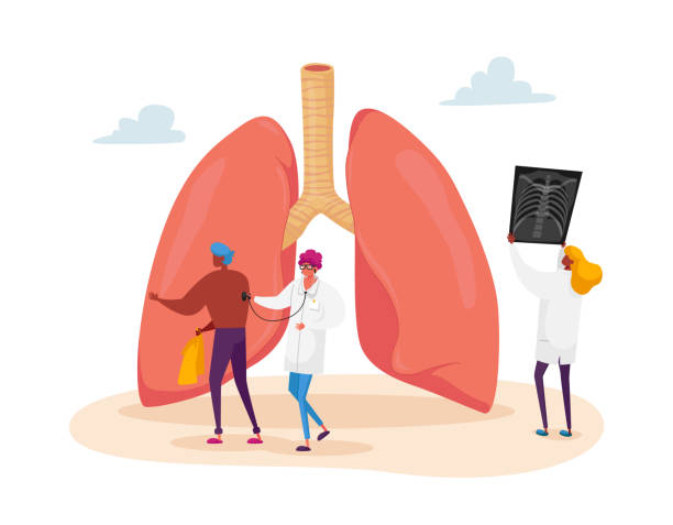 ilustraciones, imágenes clip art, dibujos animados e iconos de stock de personaje médico sosteniendo imágenes de rayos x de los pulmones aprendizaje de la fluorografía del paciente con asma, tuberculosis o neumonía - neumonía