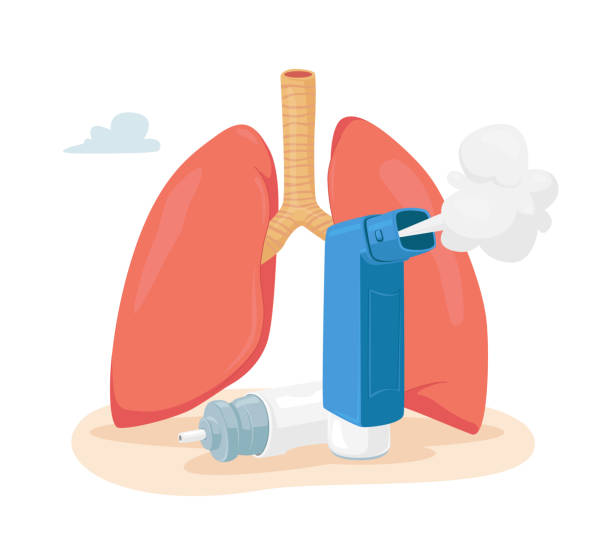 asthma-krankheit konzept. menschliche lunge und inhalator für die atmung. chronische krankheit, atemwegserkrankungen, abhilfe - asthmainhalator stock-grafiken, -clipart, -cartoons und -symbole