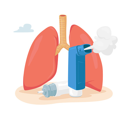 Asthma Disease Concept. Human Lungs and Inhaler for Breathing. Chronic Sickness, Respiratory System Disease, Medical Equipment, Remedy for Treatment. Pulmonology Medicine. Cartoon Vector Illustration