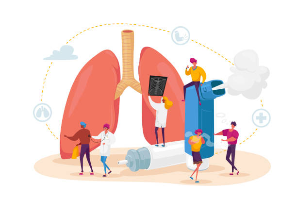 ilustraciones, imágenes clip art, dibujos animados e iconos de stock de neumología y enfermedad del asma. caracteres diminutos en enormes pulmones e inhaladores, examen y tratamiento del sistema respiratorio - inhalador de asma