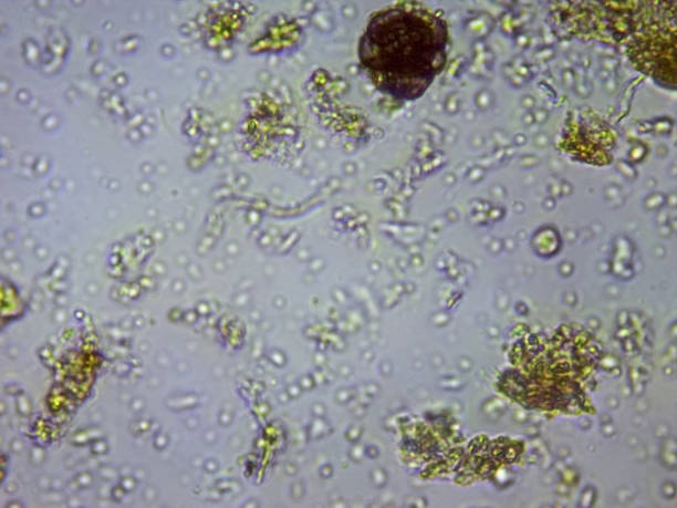 istock photo of fungi and amoebae viewed through a microscope 1268184520
