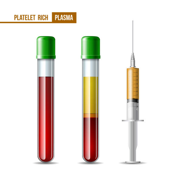 ilustrações de stock, clip art, desenhos animados e ícones de prp - several test tubes and syringe with blood and plasma for dentistry, mesotherapy - laboratory science healthcare and medicine centrifuge