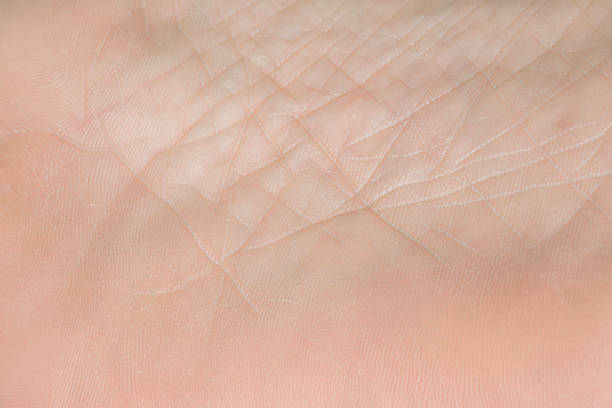 istock Close up skin texture with wrinkles on body human 1268290711