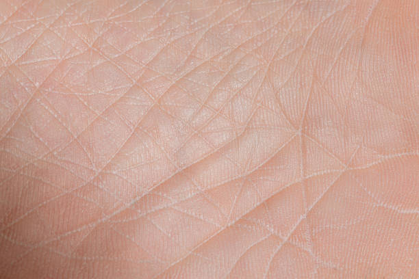 istock Close up skin texture with wrinkles on body human 1268290736