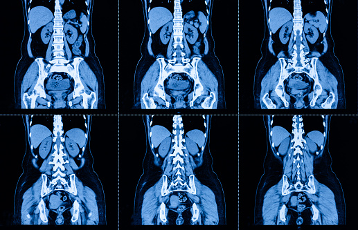 MRI Scan Human Abdominal Tomography