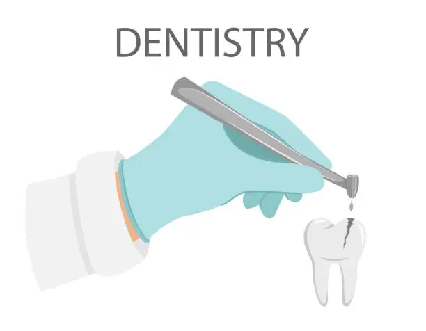 Vector illustration of Dental treatment. A gloved hand holds a dental drill.Treatment of caries, drilling tooth. Professional appointment with the dentist. Tooth with a carious cavity.Oral hygiene. flat vector illustration