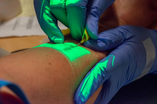 Inserting Hypodermic Needle with Vein Finder and Butterfly stock photo