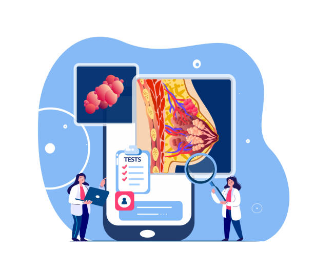 illustrazioni stock, clip art, cartoni animati e icone di tendenza di mammologist scientist doctor examine female breast.lacteal gland online smartphone ultrasound,cancer swelling test.medical council.tumor x-ray internet diagnostic.digital treatment.vector illustration - lactiferous duct