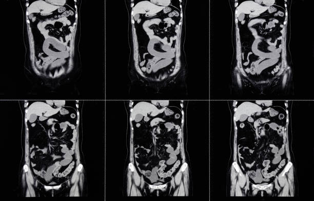 MRI Scan Human Abdominal Tomography MRI Scan Human Abdominal Tomography abdominal cavity stock pictures, royalty-free photos & images