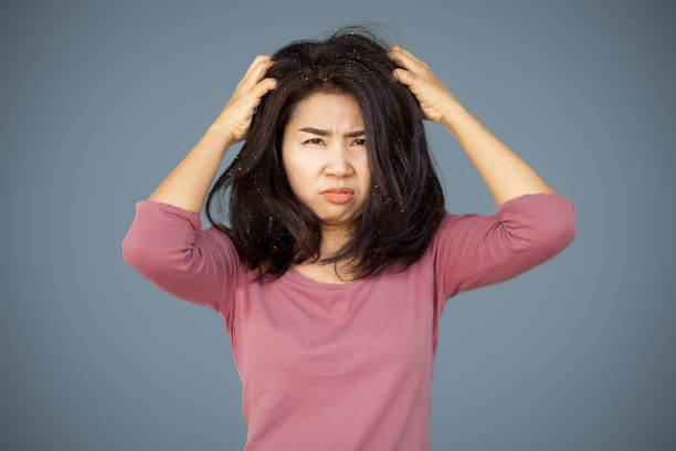 Asian woman hair having problem with dandruff hand itching her dry skin on head Asian woman hair having problem with dandruff hand itching her dry skin on head hair care women mature adult human skin stock pictures, royalty-free photos & images