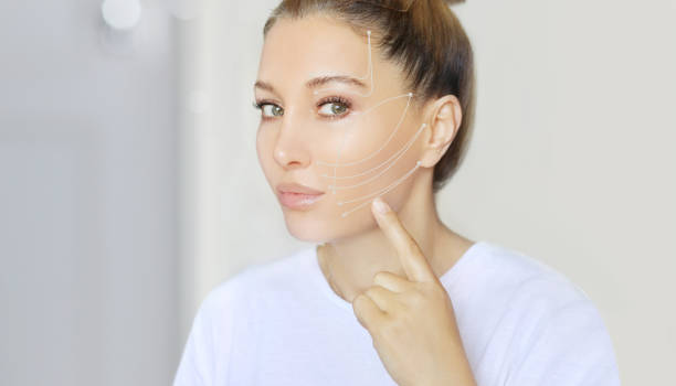 thread lift procedure ,non-surgical facelift,markup thread lift procedure ,non-surgical facelift,markup skin cheek stock pictures, royalty-free photos & images