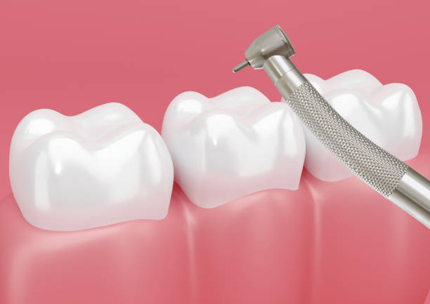istock patient's tooth treated with dental drill to remove cavities. 1269112778