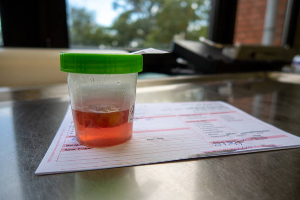 histological tissue preparation after an operation is on a lab time - nitril imagens e fotografias de stock