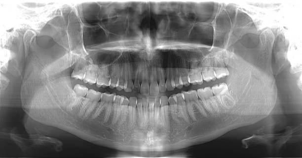 3D Dental Cone Beam CT Scans and 2D OPG (Orthopantomagram), Dental X-Ray stock photo