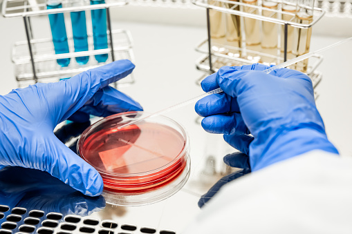Researcher working with petri plate in a microbiology laboratory. hand of a technician inoculating plate. cultivating petri dishes in the lab. In the background are test tubes with multi-colored liquids