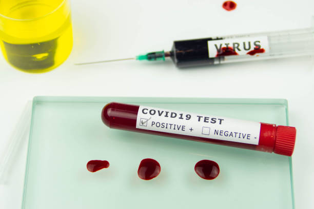 corona covid 19 test tube positivo campione esame del sangue gocce ago siringa del sangue - blood blood sample blood donation tube foto e immagini stock