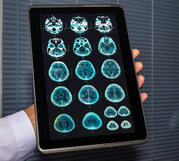 istock MRI of the brain. 1269350597