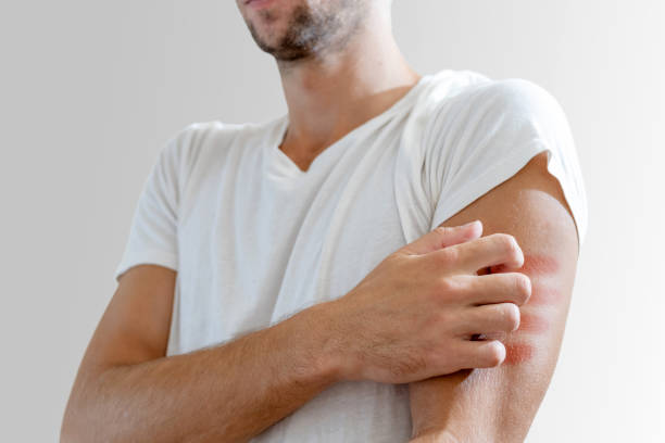 istock young man scratches his hand 1269414582