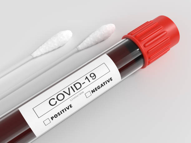 coronavirus covid-19 tubo de teste de sangue positivo com cotonetes de algodão - transgenic cotton - fotografias e filmes do acervo