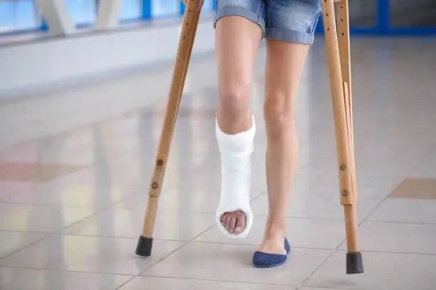 Photo of A young girl is on crutches in the corridor of the hospital