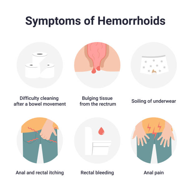 ilustrações de stock, clip art, desenhos animados e ícones de set symptoms of hemorrhoids - hemorrhoid