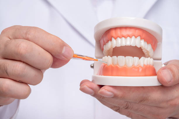 A dentist holding a tooth model and an interdental brush. stock photo