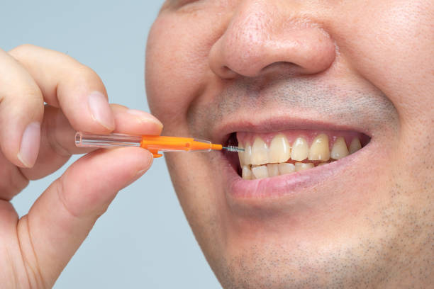 Man cleaning his teeth with an interdental brush. stock photo