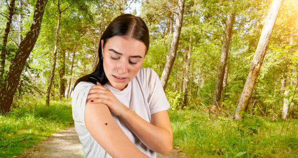 istock tick sits on a woman's arm in the forest 1270397638