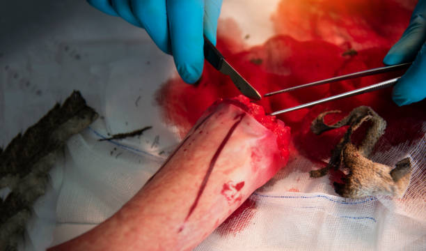 istock Autopsy Body surgeon during the survey,Dead person. 1270552268